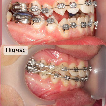 Наталія Витівська, Львів Фото - 28