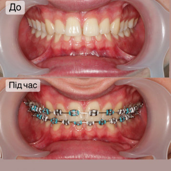 Наталія Витівська, Львів Фото - 31