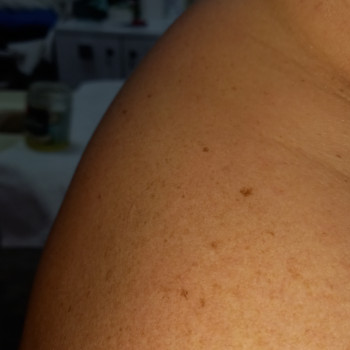 Массаж воротниковой зоны
                    Массажист Валентина Кременчуг