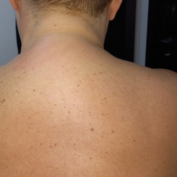 Массаж воротниковой зоны
                    Массажист Валентина Кременчуг