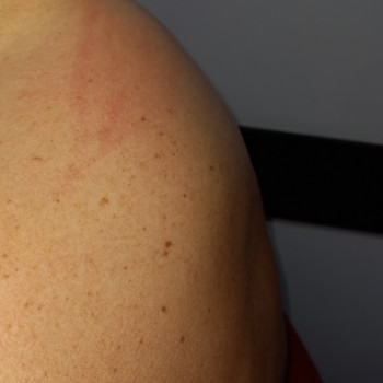 Массаж воротниковой зоны
                    Массажист Валентина Кременчуг