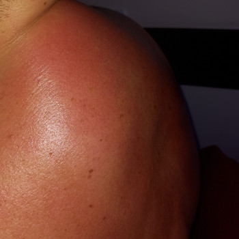 Массаж воротниковой зоны
                    Массажист Валентина Кременчуг