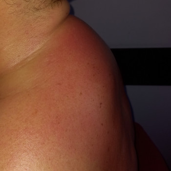 Массаж воротниковой зоны
                    Массажист Валентина Кременчуг