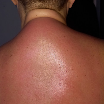 Массаж воротниковой зоны
                    Массажист Валентина Кременчуг