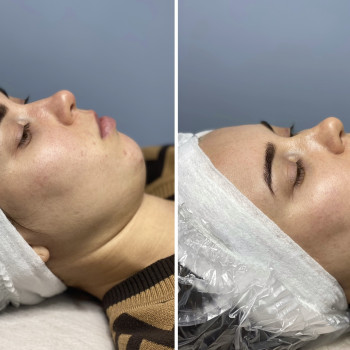 Лілія Кожем'якіна, Днепр Фото - 5