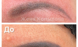 Видалення татуажу брів лазером Мастер перманентного макияжа Женя Днепр