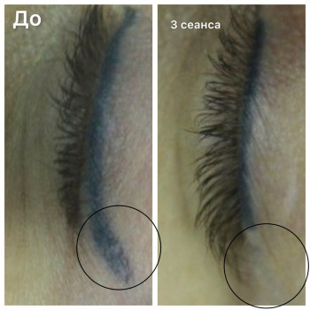 Фото из портфолио мастера Женя Копылова (мастер перманентного макияжа, Днепр)