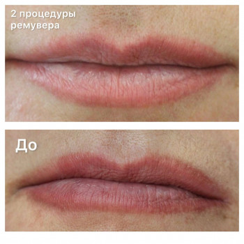 Женя Копилова, Дніпро Фото - 11