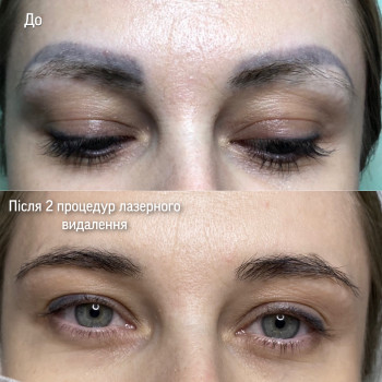 Наталія Дацюк, Луцьк Фото - 9