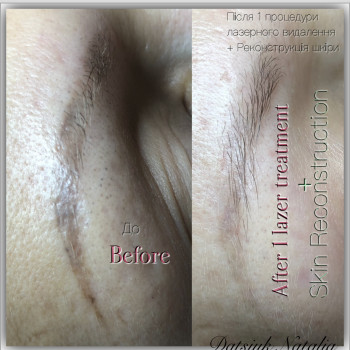 Наталія Дацюк, Луцьк Фото - 20