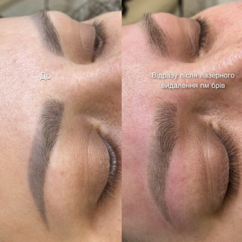 Наталія Дацюк, Луцьк Фото - 22