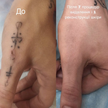 Наталія Дацюк, Луцьк Фото - 23