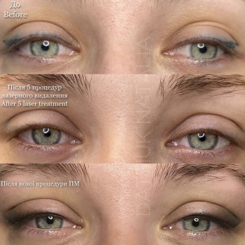 Наталія Дацюк, Луцьк Фото - 24