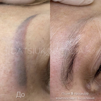 Наталія Дацюк, Луцьк Фото - 26