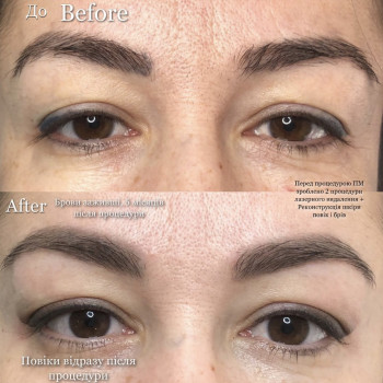 Наталія Дацюк, Луцьк Фото - 35