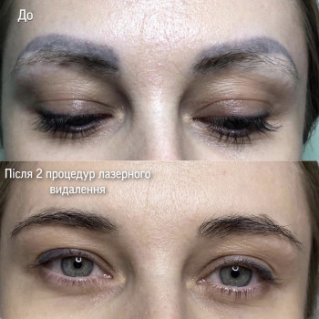 Наталія Дацюк, Луцьк Фото - 37