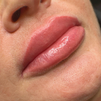 Валентина Шибицкая, Винница Фото - 14