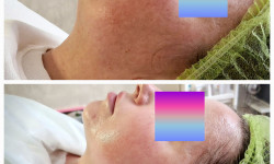 Polivitaminic Косметолог-инъекционист Надежда Киев