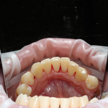 Професійна гігієна