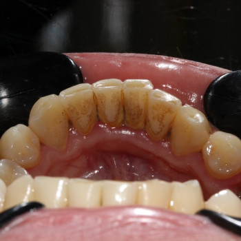 Ольга Більська, Ивано-Франковск Фото - 7