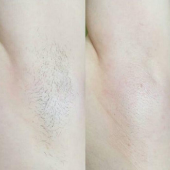 Катерина Боцян, Київ Фото - 8