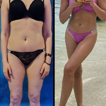 Результат комплексної роботи: •16 сеансів масажу   +8обго