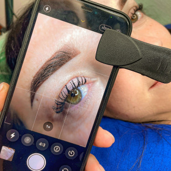 Зразу після процедури