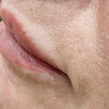 Електроепіляція
                    Майстер депіляції Ірина Рівне