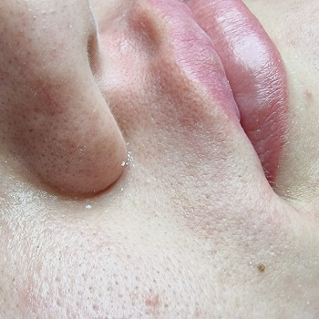 Електроепіляція
                    Майстер депіляції Ірина Рівне