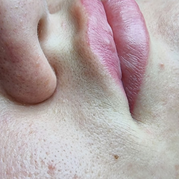 Електроепіляція
                    Майстер депіляції Ірина Рівне