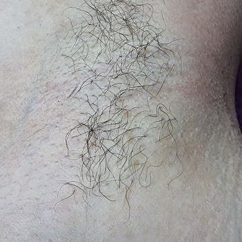 Електроепіляція
                    Майстер депіляції Ірина Рівне