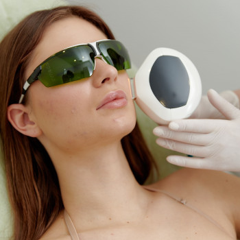 Фотоомолодження IPL Lumecca
                    Косметологический центр Skin Studio Beauty FULL Львов