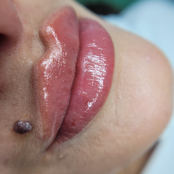 Увеличения губ
                    Мастер перманентного макияжа Любовь Одесса