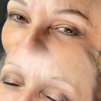 Волоскове напилення