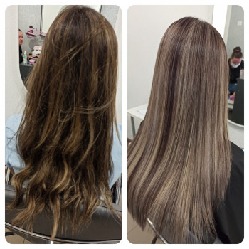 Колагенопластія