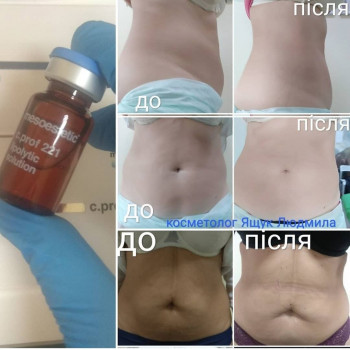 Людмила Ящук, Винница Фото - 19