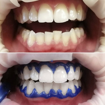 Віолета Максименко, Одесса Фото - 6