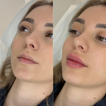 Дар'я Дідковська, Київ Фото - 5