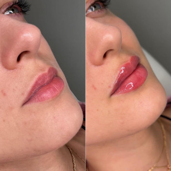 Дар'я Дідковська, Київ Фото - 8