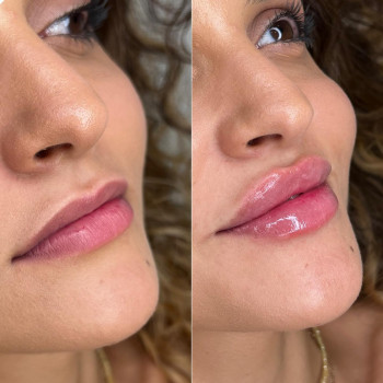 Дар'я Дідковська, Київ Фото - 13