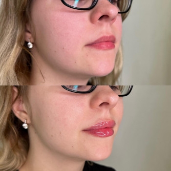 Дар'я Дідковська, Київ Фото - 18