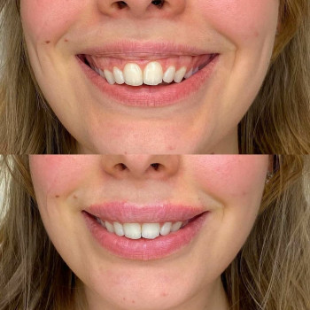 Дар'я Дідковська, Київ Фото - 20