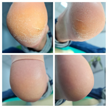 Лілія Шевченко, Київ Фото - 5