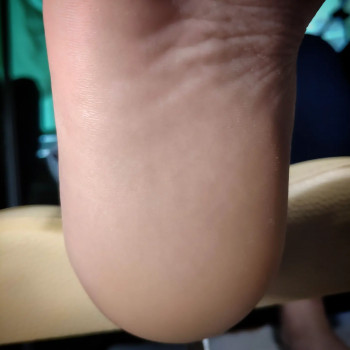 Апаратний педикюр