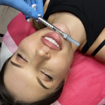 Катерина Гусак, Вінниця Фото - 6