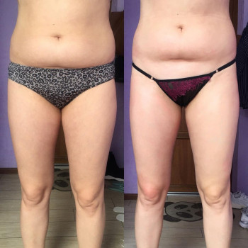 Just massage studio, Кам'янське Фото - 5