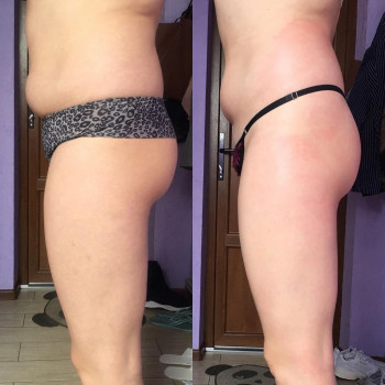 Just massage studio, Кам'янське Фото - 6