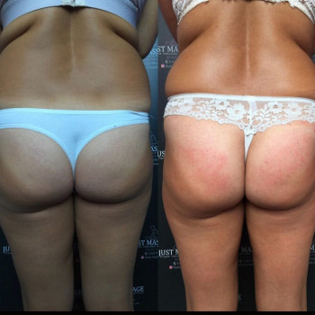 Just massage studio, Кам'янське Фото - 7