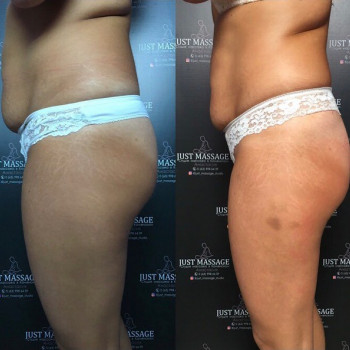 Just massage studio, Кам'янське Фото - 8