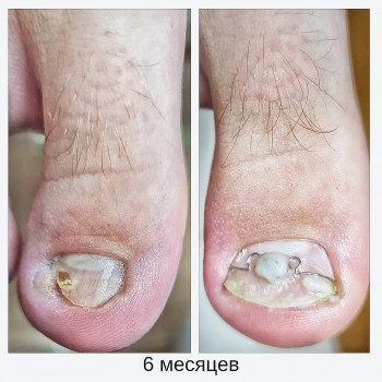 Руслана Петровна Гончарова, Одесса Фото - 23